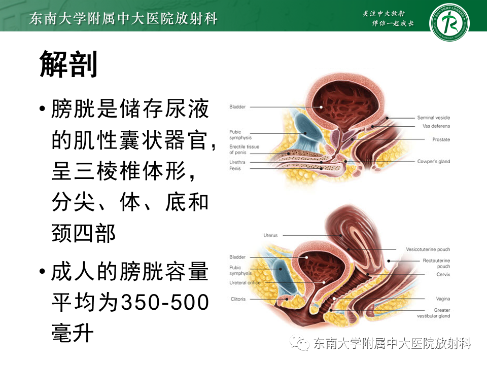影像PPT - 【PPT】膀胱癌-13 影像PPT - 【PPT】膀胱癌-13