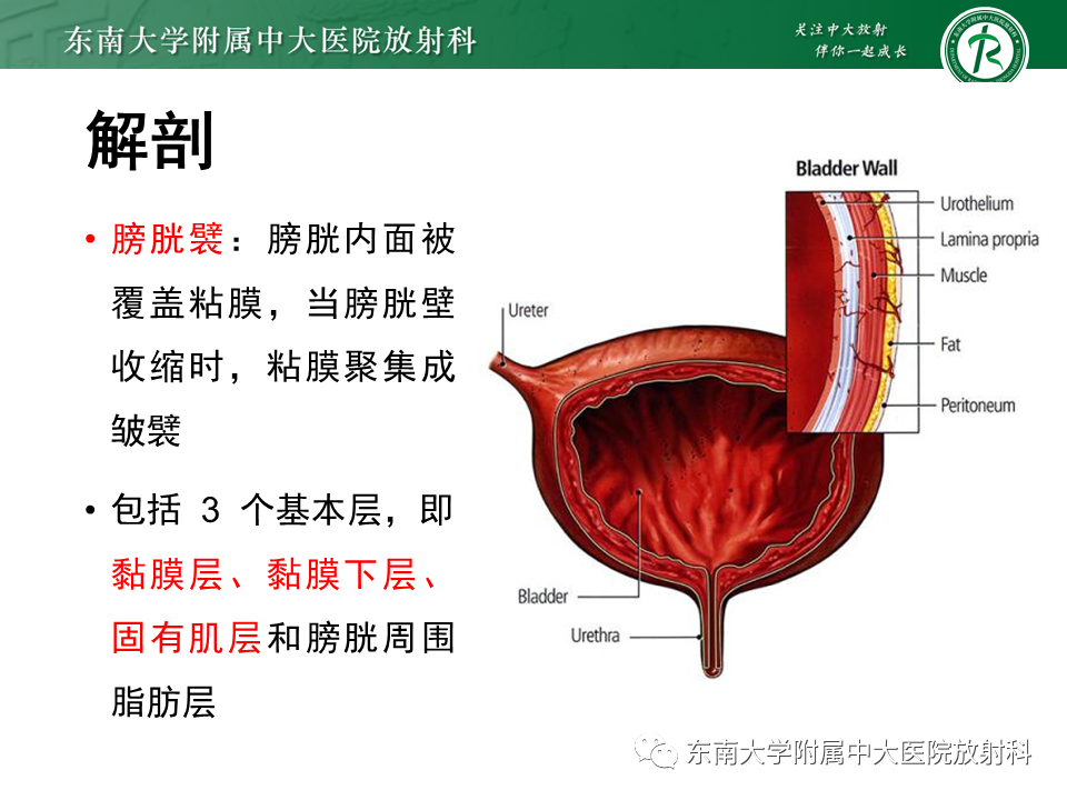 影像PPT - 【PPT】膀胱癌-15 影像PPT - 【PPT】膀胱癌-15