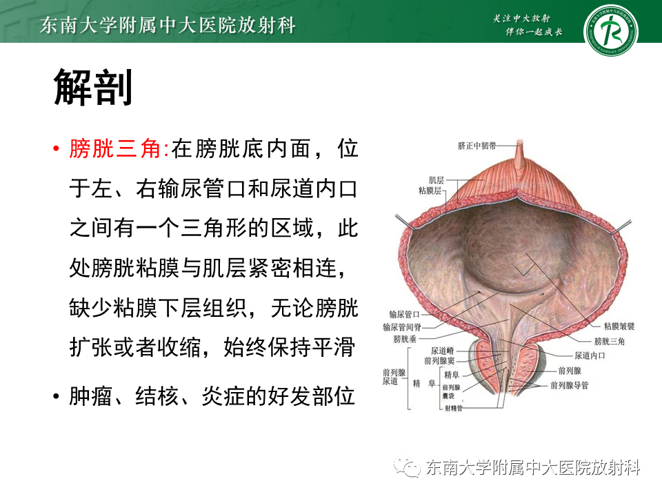 影像PPT - 【PPT】膀胱癌-14 影像PPT - 【PPT】膀胱癌-14