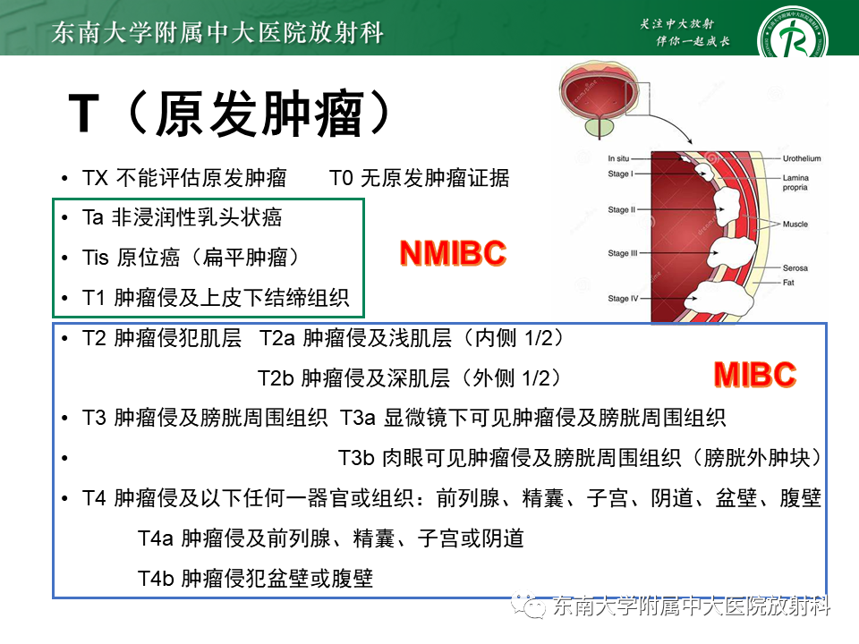 影像PPT - 【PPT】膀胱癌-18 影像PPT - 【PPT】膀胱癌-18