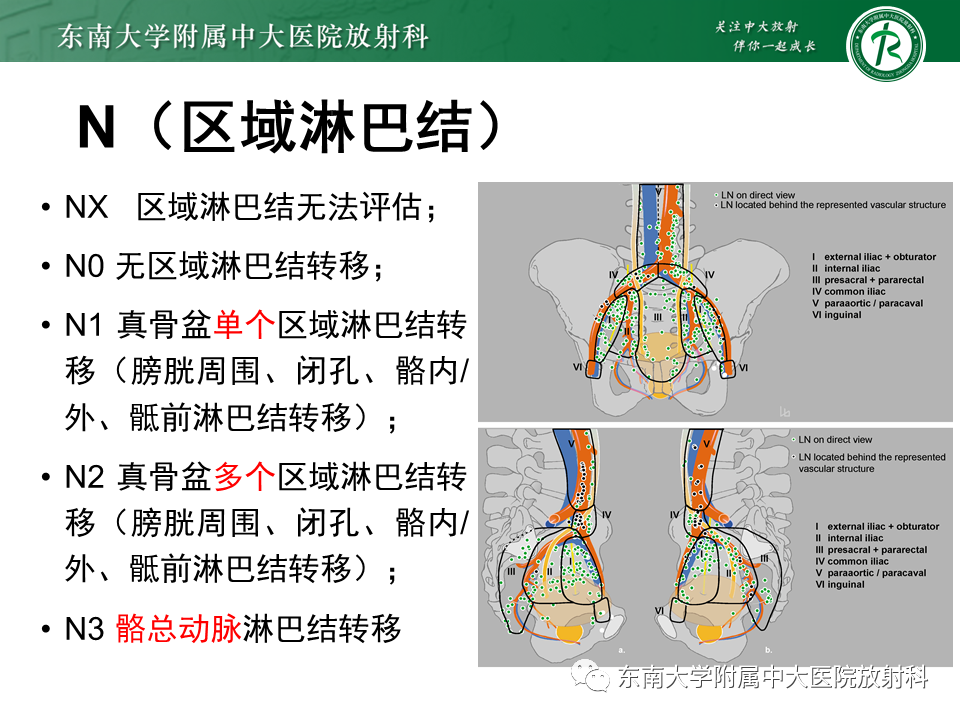 影像PPT - 【PPT】膀胱癌-19 影像PPT - 【PPT】膀胱癌-19