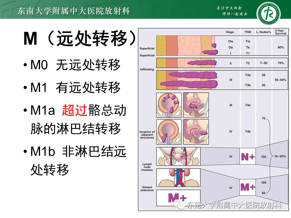 影像PPT - 【PPT】膀胱癌-20 影像PPT - 【PPT】膀胱癌-20