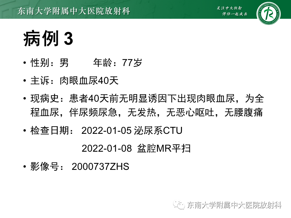 影像PPT - 【PPT】膀胱癌-25 影像PPT - 【PPT】膀胱癌-25