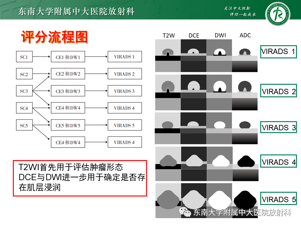 影像PPT - 【PPT】膀胱癌-31 影像PPT - 【PPT】膀胱癌-31