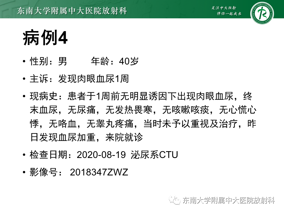 影像PPT - 【PPT】膀胱癌-39 影像PPT - 【PPT】膀胱癌-39