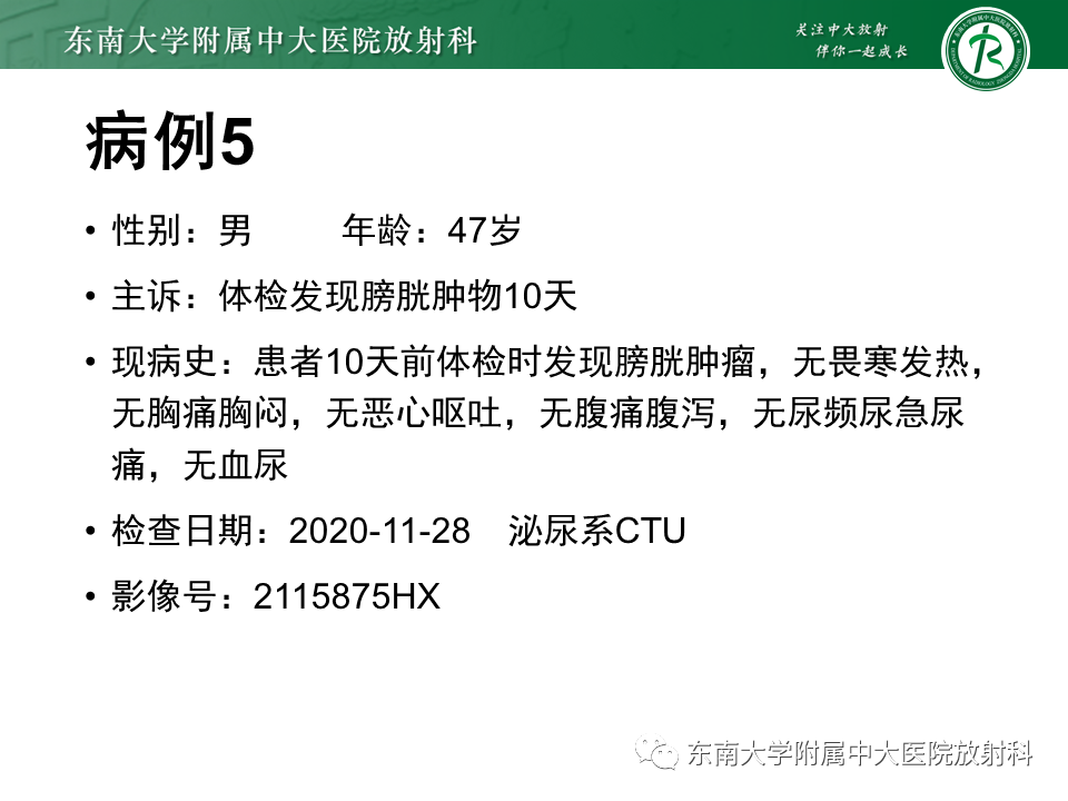影像PPT - 【PPT】膀胱癌-44 影像PPT - 【PPT】膀胱癌-44