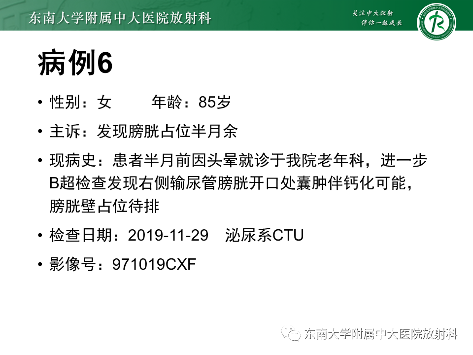 影像PPT - 【PPT】膀胱癌-49 影像PPT - 【PPT】膀胱癌-49