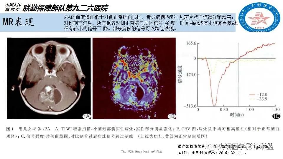 影像PPT - 【PPT】幕下毛细胞型星形细胞瘤的MR分析-13