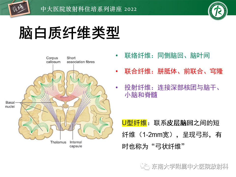 影像PPT - 【PPT】皮层下U形纤维受累常见病变-3