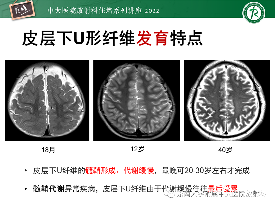 影像PPT - 【PPT】皮层下U形纤维受累常见病变-7