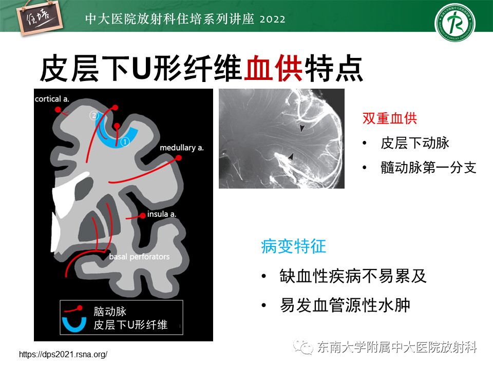 影像PPT - 【PPT】皮层下U形纤维受累常见病变-8
