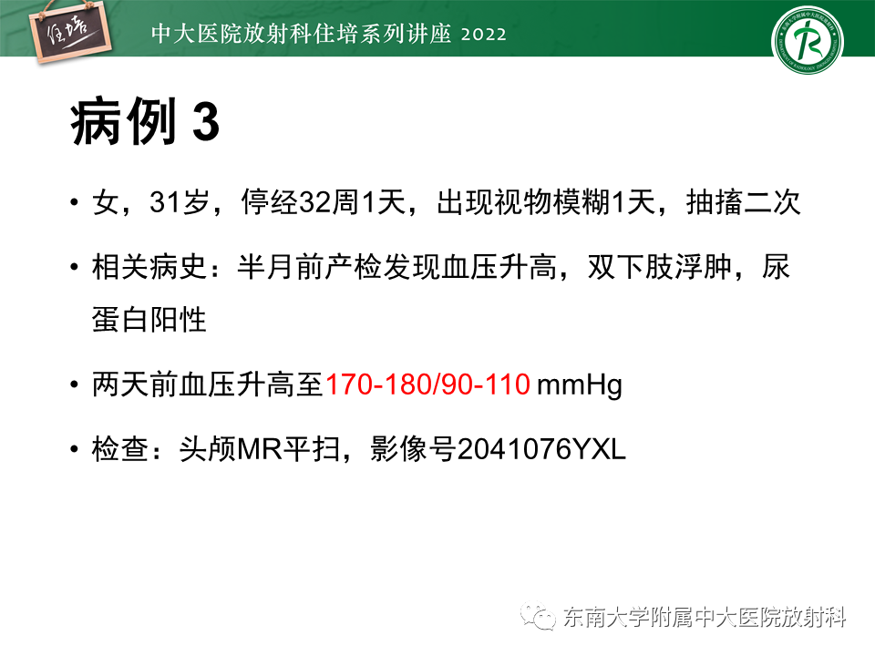影像PPT - 【PPT】皮层下U形纤维受累常见病变-24