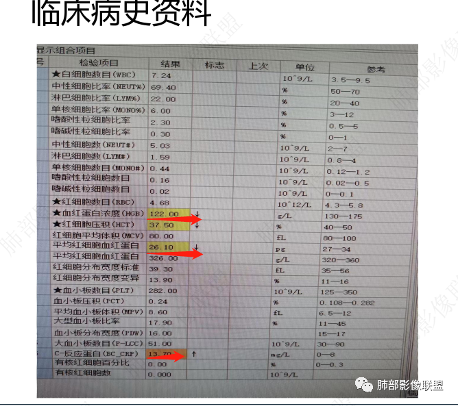 影像PPT - 【病例】肺部这样的片状影,你是否能一锤定音?-13 影像PPT - 【病例】肺部这样的片状影,你是否能一锤定音?-13