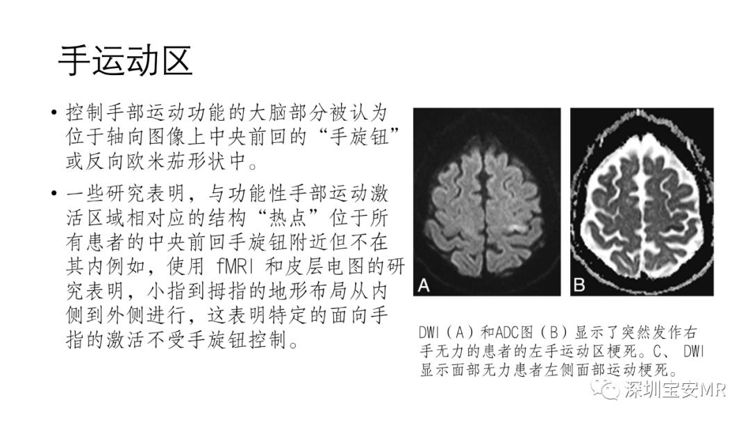 影像PPT - 【PPT】脑功能成像解剖-8