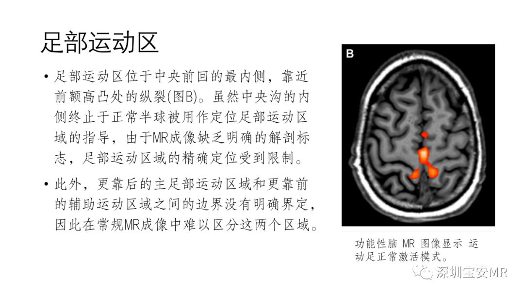 影像PPT - 【PPT】脑功能成像解剖-9