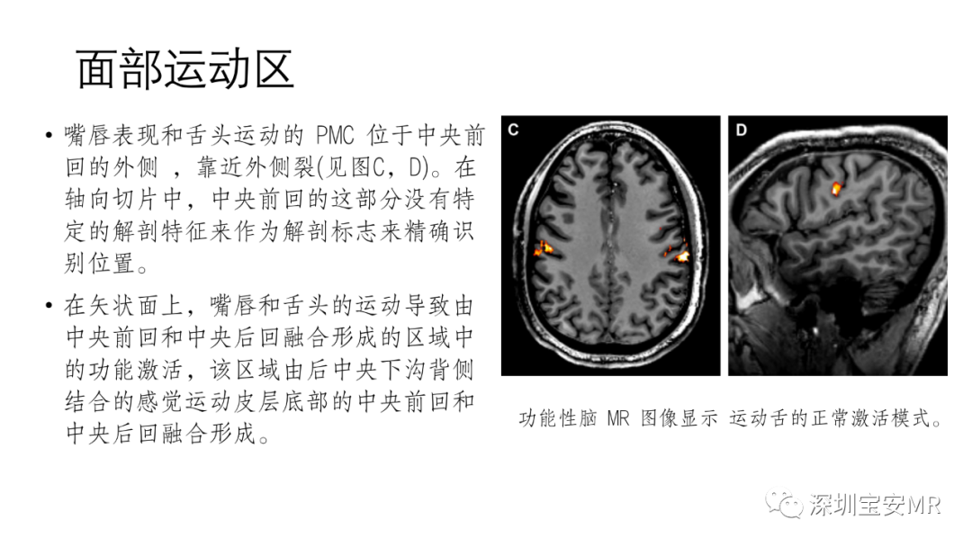 影像PPT - 【PPT】脑功能成像解剖-11