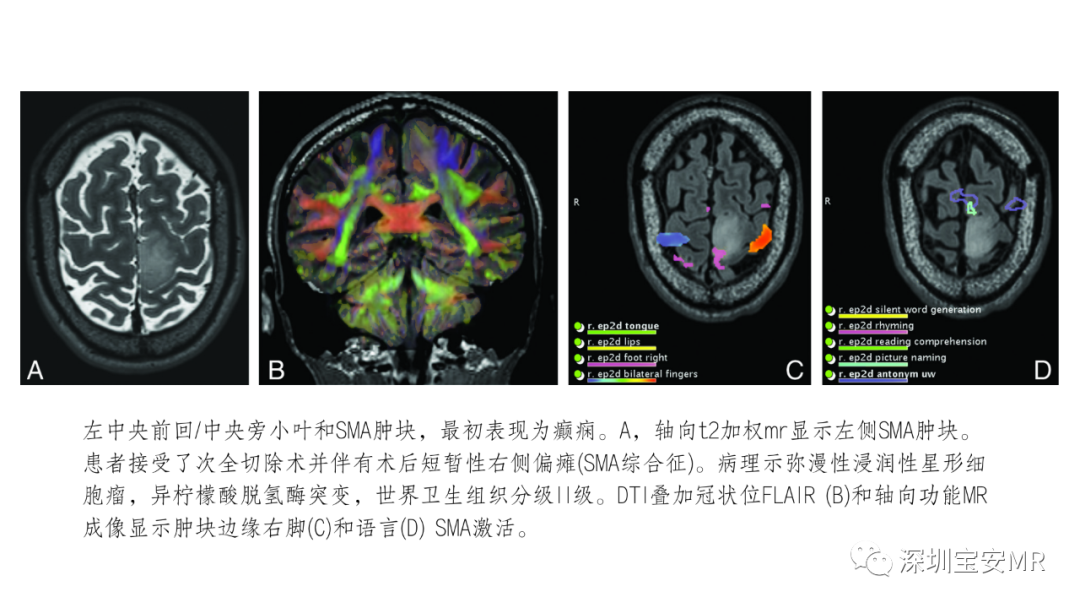 影像PPT - 【PPT】脑功能成像解剖-16