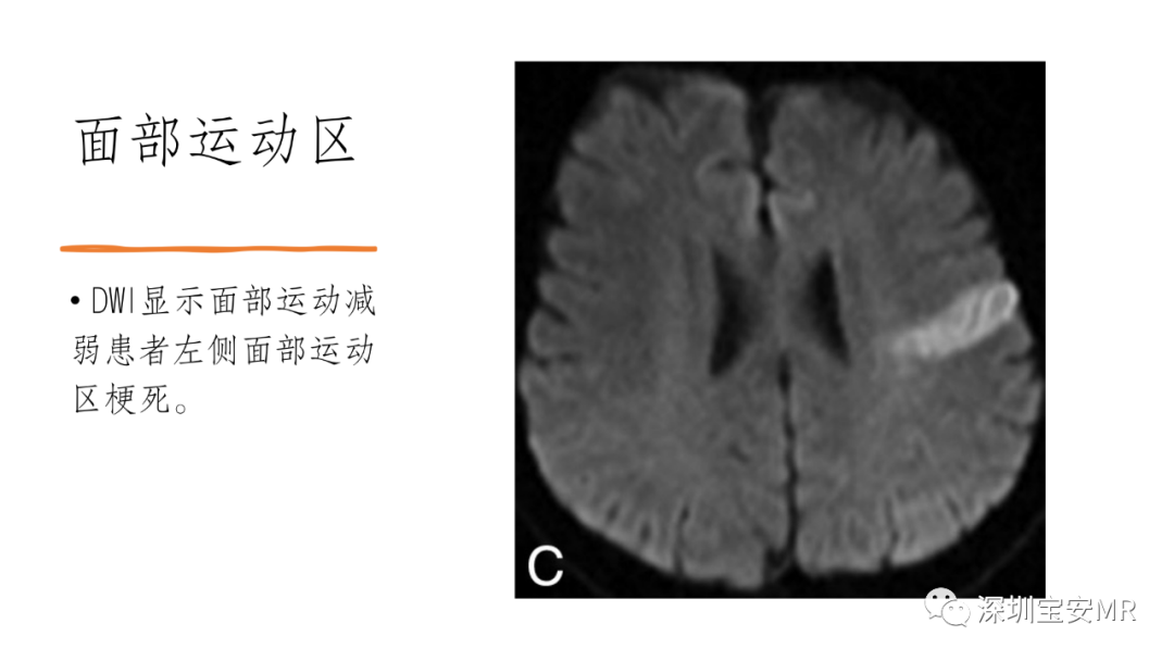 影像PPT - 【PPT】脑功能成像解剖-12