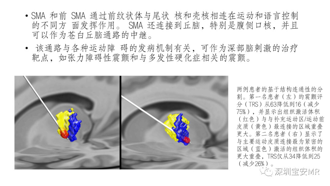 影像PPT - 【PPT】脑功能成像解剖-18