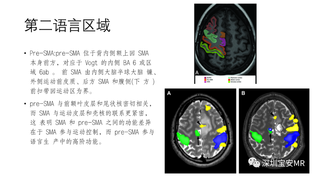 影像PPT - 【PPT】脑功能成像解剖-26