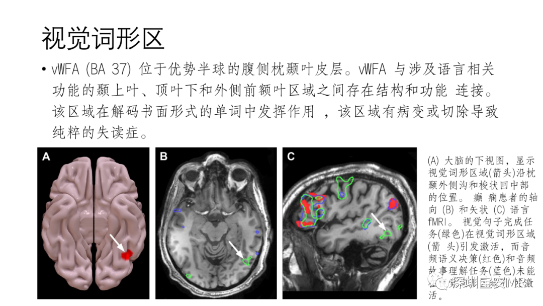 影像PPT - 【PPT】脑功能成像解剖-30