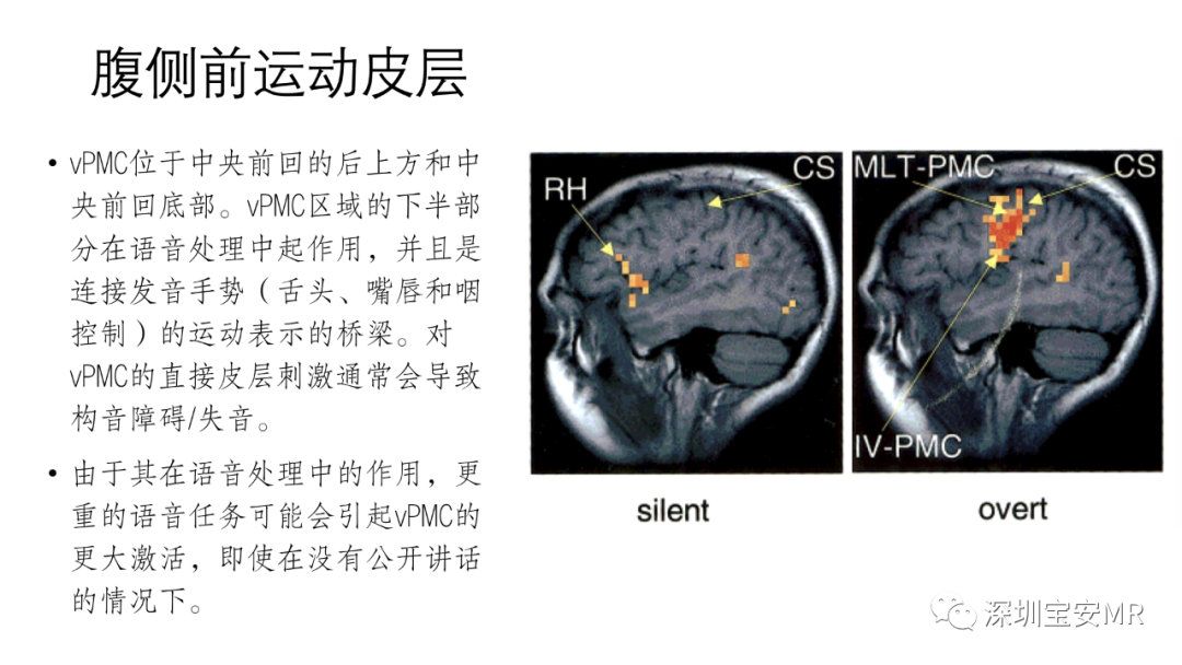 影像PPT - 【PPT】脑功能成像解剖-31