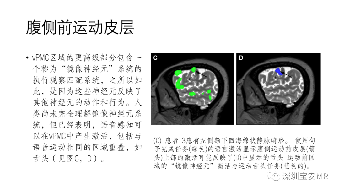 影像PPT - 【PPT】脑功能成像解剖-32