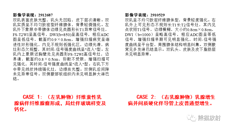 影像PPT - 【病例】纤维囊性乳腺病伴纤维腺瘤形成 VS 乳腺增生病并间质硬化-9