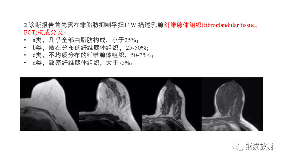 影像PPT - 【病例】纤维囊性乳腺病伴纤维腺瘤形成 VS 乳腺增生病并间质硬化-12