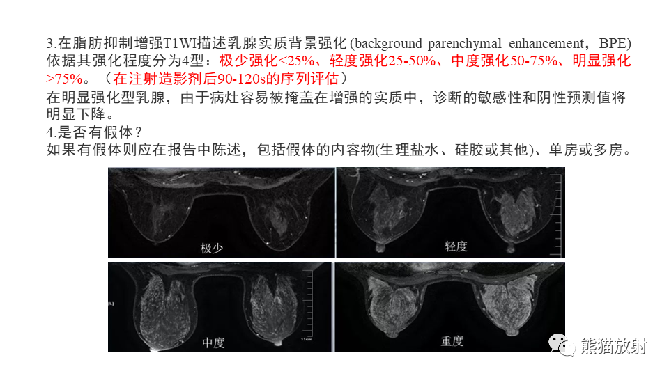 影像PPT - 【病例】纤维囊性乳腺病伴纤维腺瘤形成 VS 乳腺增生病并间质硬化-13