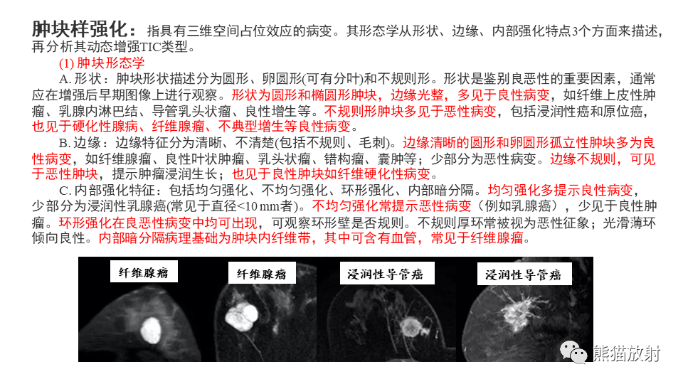 影像PPT - 【病例】纤维囊性乳腺病伴纤维腺瘤形成 VS 乳腺增生病并间质硬化-16