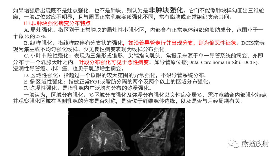 影像PPT - 【病例】纤维囊性乳腺病伴纤维腺瘤形成 VS 乳腺增生病并间质硬化-18