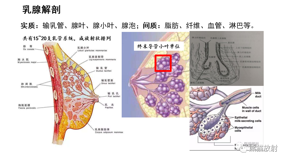 影像PPT - 【病例】纤维囊性乳腺病伴纤维腺瘤形成 VS 乳腺增生病并间质硬化-21