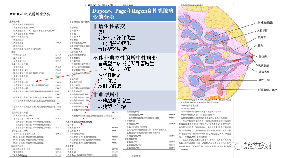 影像PPT - 【病例】纤维囊性乳腺病伴纤维腺瘤形成 VS 乳腺增生病并间质硬化-22
