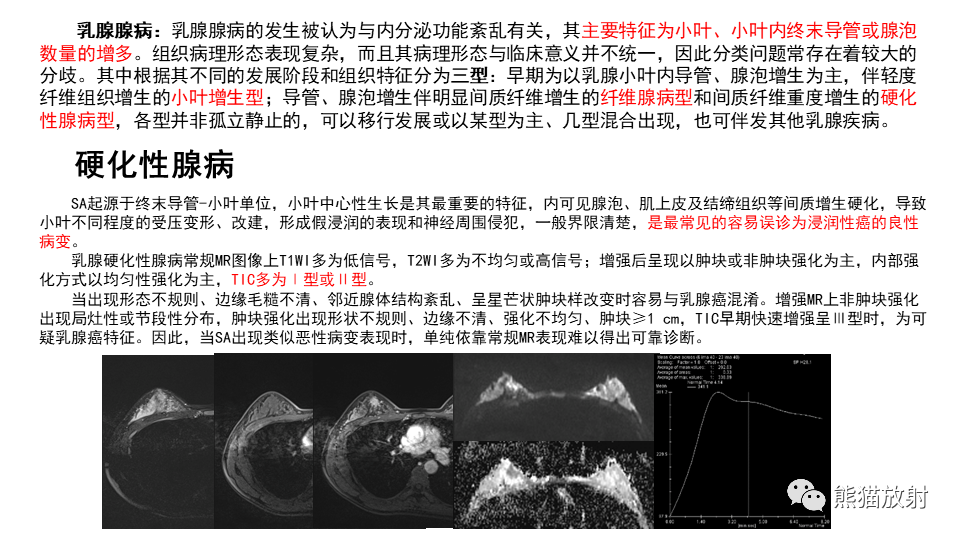影像PPT - 【病例】纤维囊性乳腺病伴纤维腺瘤形成 VS 乳腺增生病并间质硬化-23