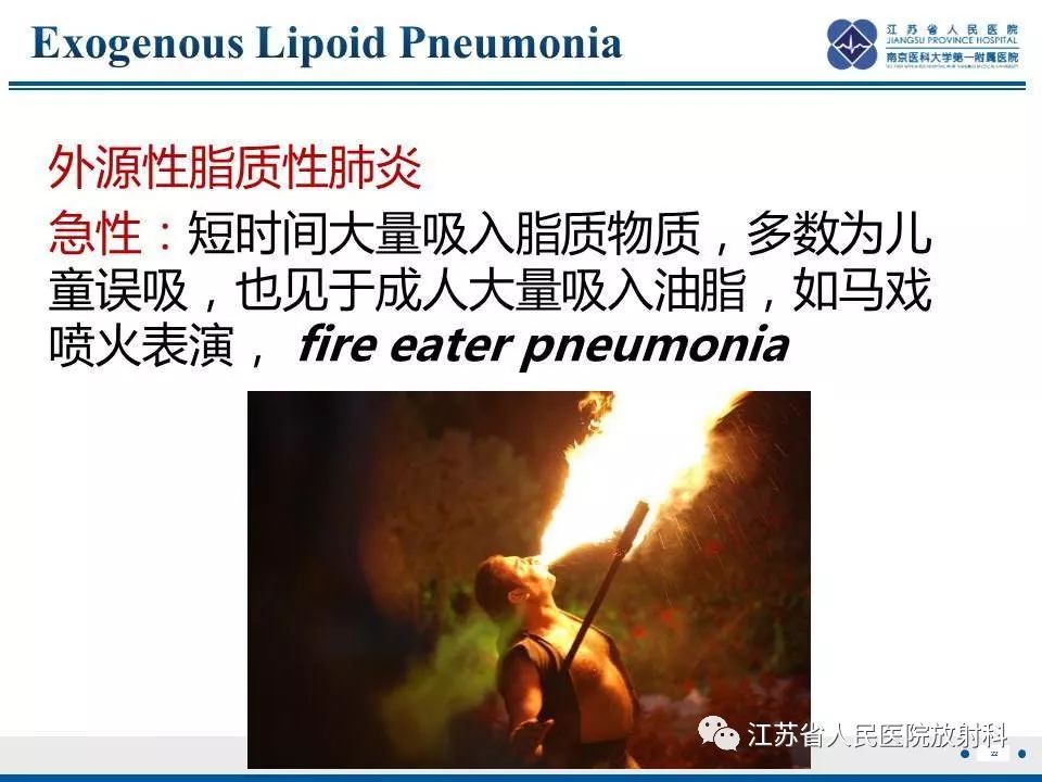 影像PPT - 【PPT】脂质性肺炎-22