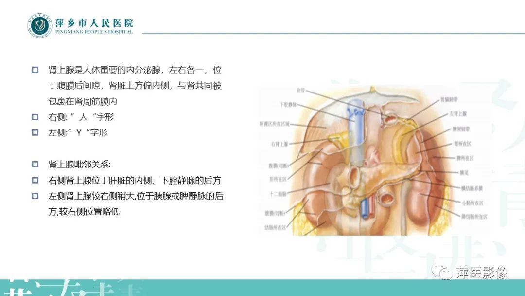 影像PPT - 【PPT】肾上腺嗜铬细胞瘤及肾上腺占位性病变-4