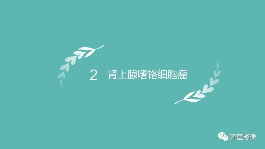 影像PPT - 【PPT】肾上腺嗜铬细胞瘤及肾上腺占位性病变-9