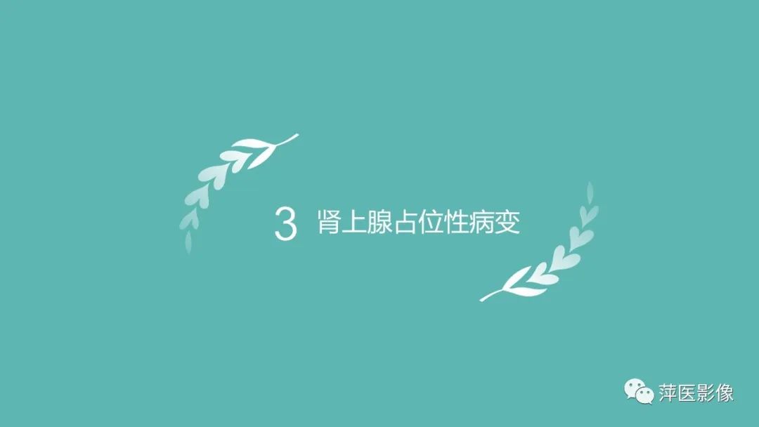 影像PPT - 【PPT】肾上腺嗜铬细胞瘤及肾上腺占位性病变-21
