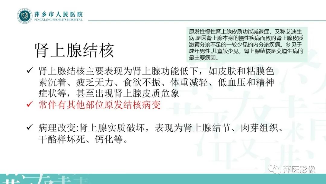 影像PPT - 【PPT】肾上腺嗜铬细胞瘤及肾上腺占位性病变-35