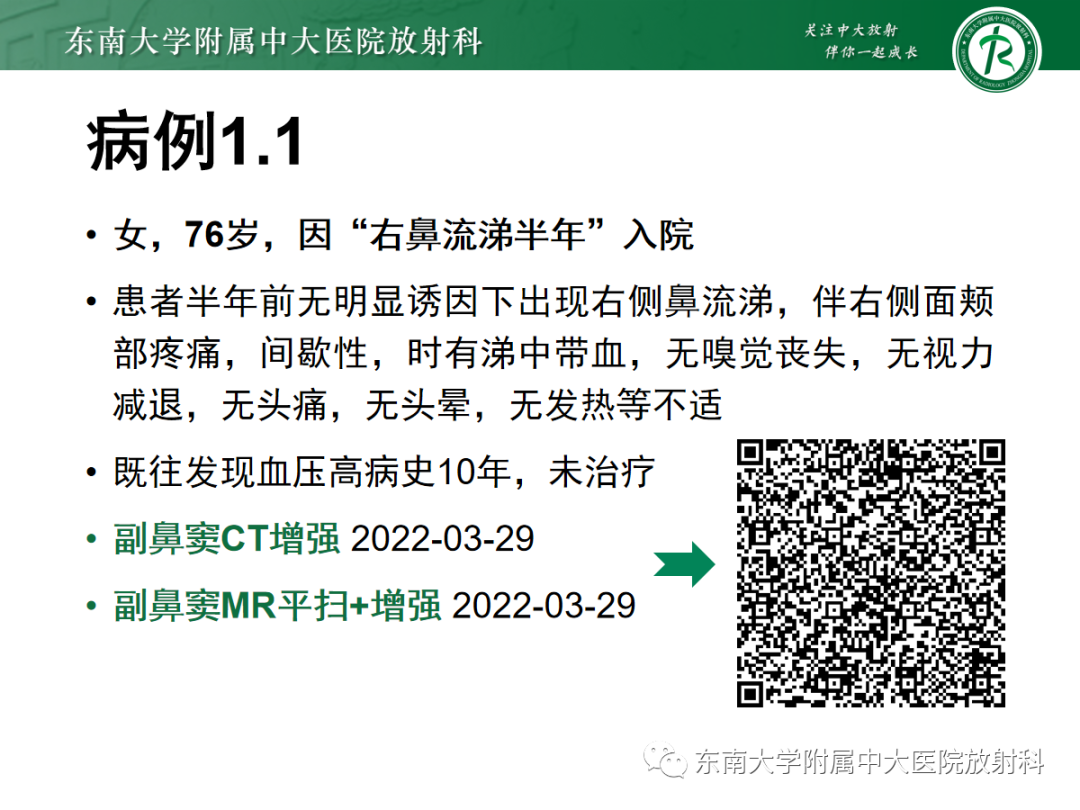 影像PPT - 【PPT】以上颌窦为中心的鼻腔鼻窦占位性病变随访-3