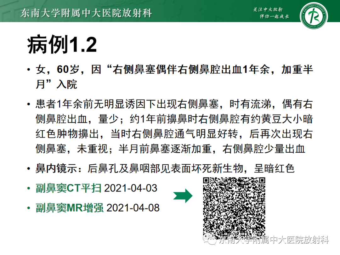 影像PPT - 【PPT】以上颌窦为中心的鼻腔鼻窦占位性病变随访-11