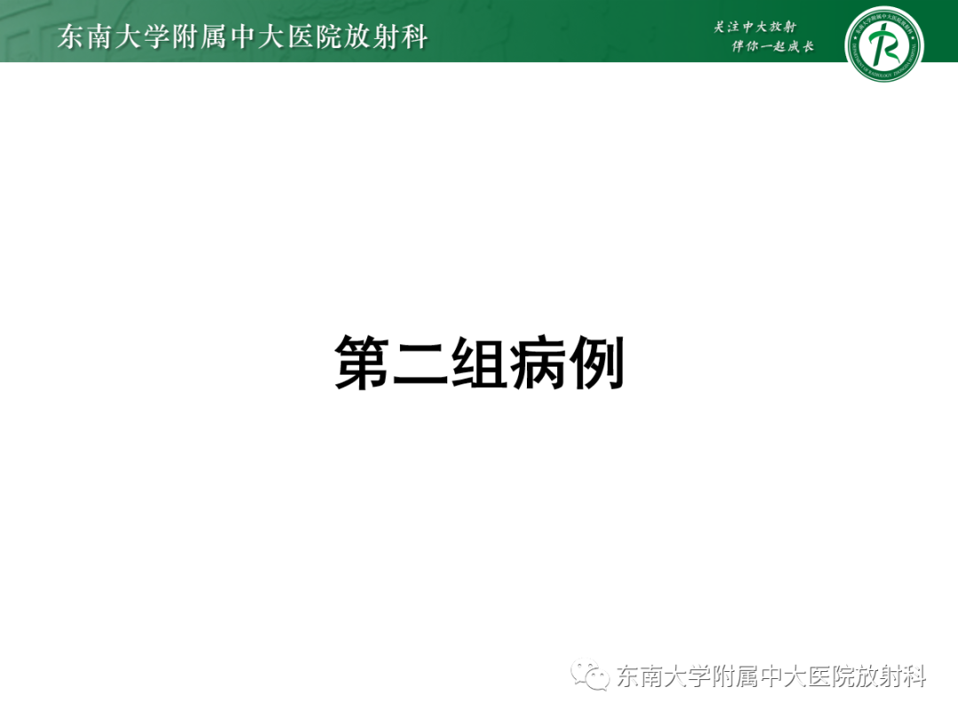 影像PPT - 【PPT】以上颌窦为中心的鼻腔鼻窦占位性病变随访-16