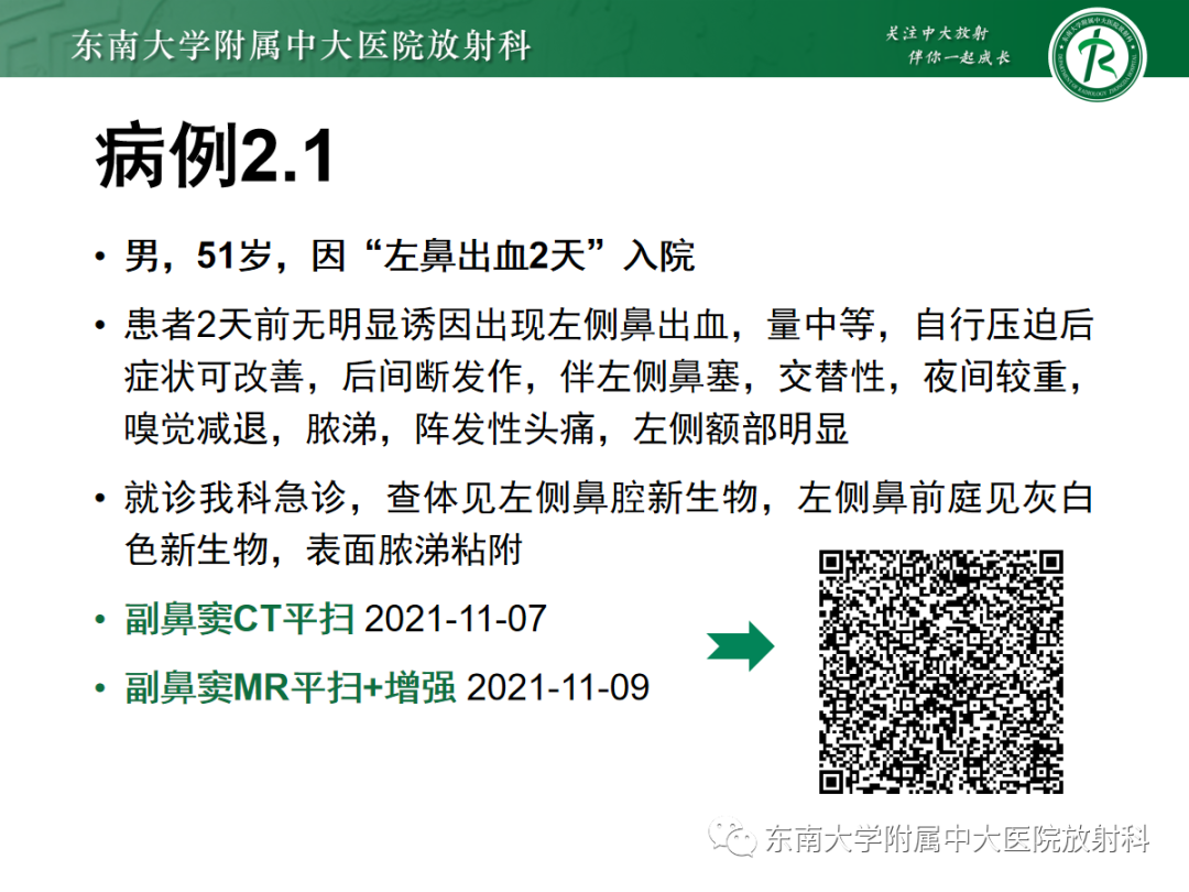 影像PPT - 【PPT】以上颌窦为中心的鼻腔鼻窦占位性病变随访-17