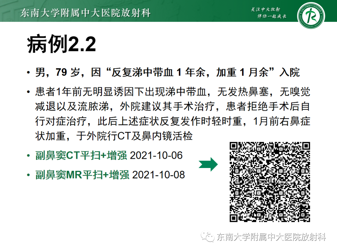 影像PPT - 【PPT】以上颌窦为中心的鼻腔鼻窦占位性病变随访-26