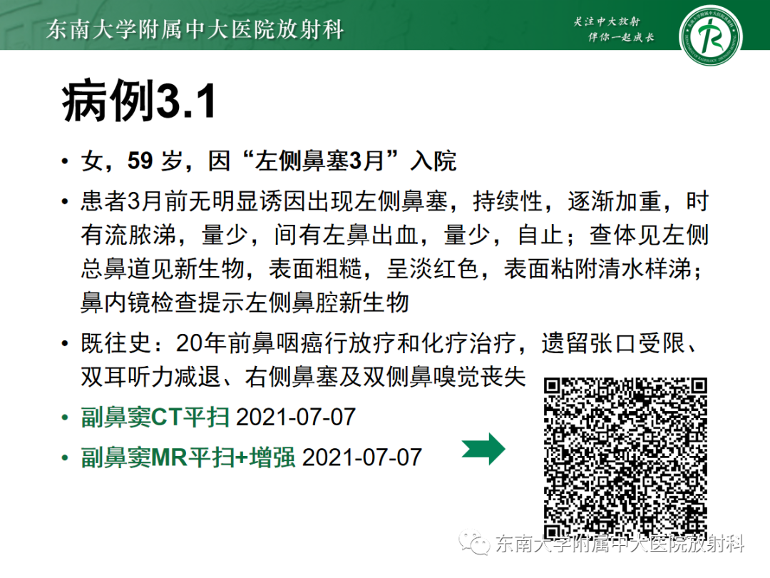 影像PPT - 【PPT】以上颌窦为中心的鼻腔鼻窦占位性病变随访-35