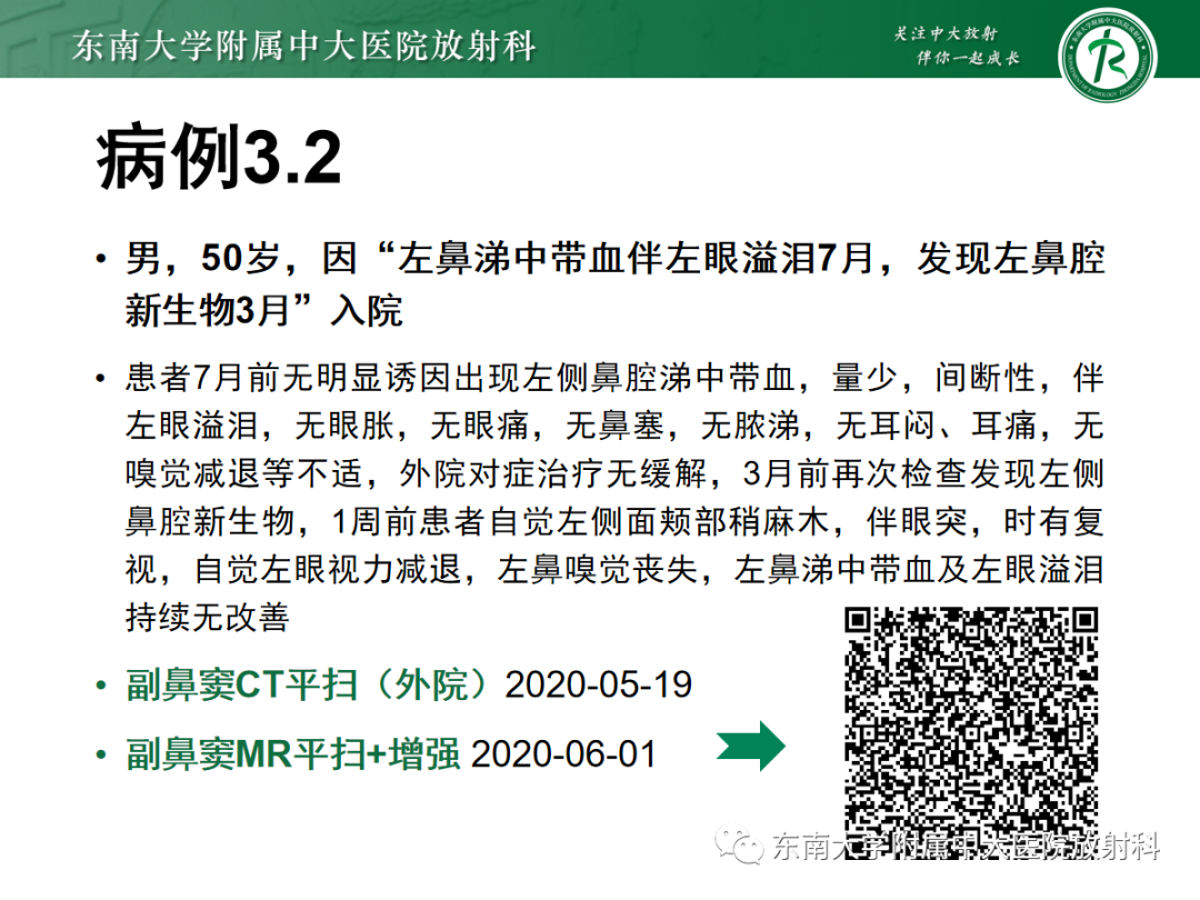 影像PPT - 【PPT】以上颌窦为中心的鼻腔鼻窦占位性病变随访-43