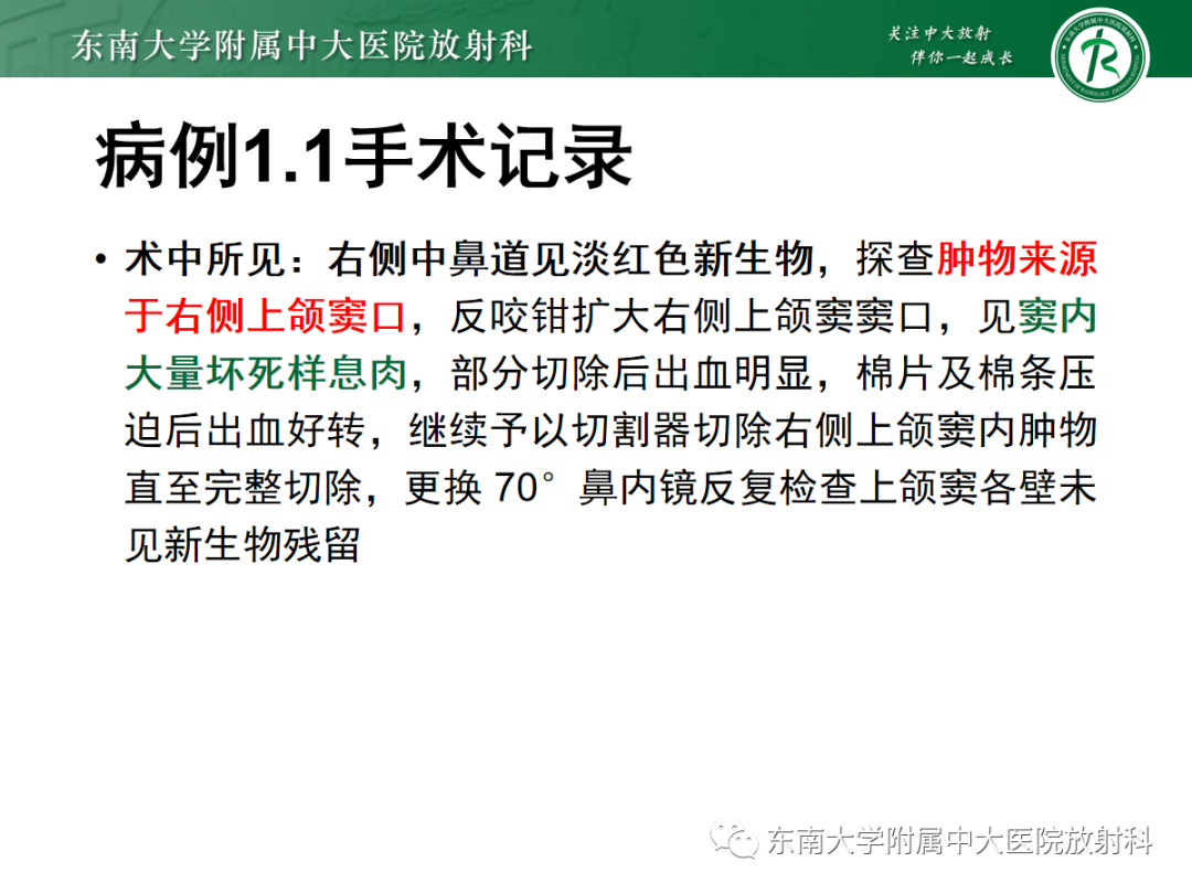 影像PPT - 【PPT】以上颌窦为中心的鼻腔鼻窦占位性病变随访-52