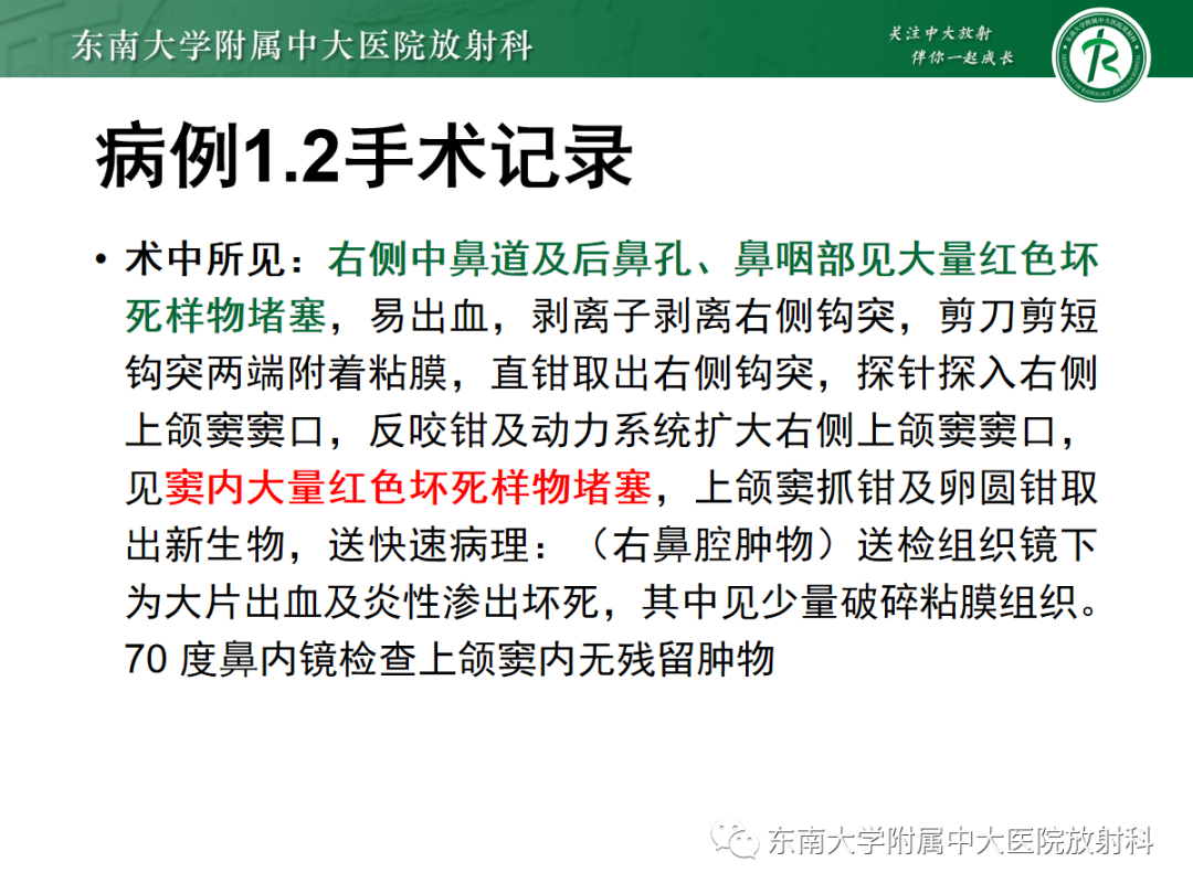 影像PPT - 【PPT】以上颌窦为中心的鼻腔鼻窦占位性病变随访-54