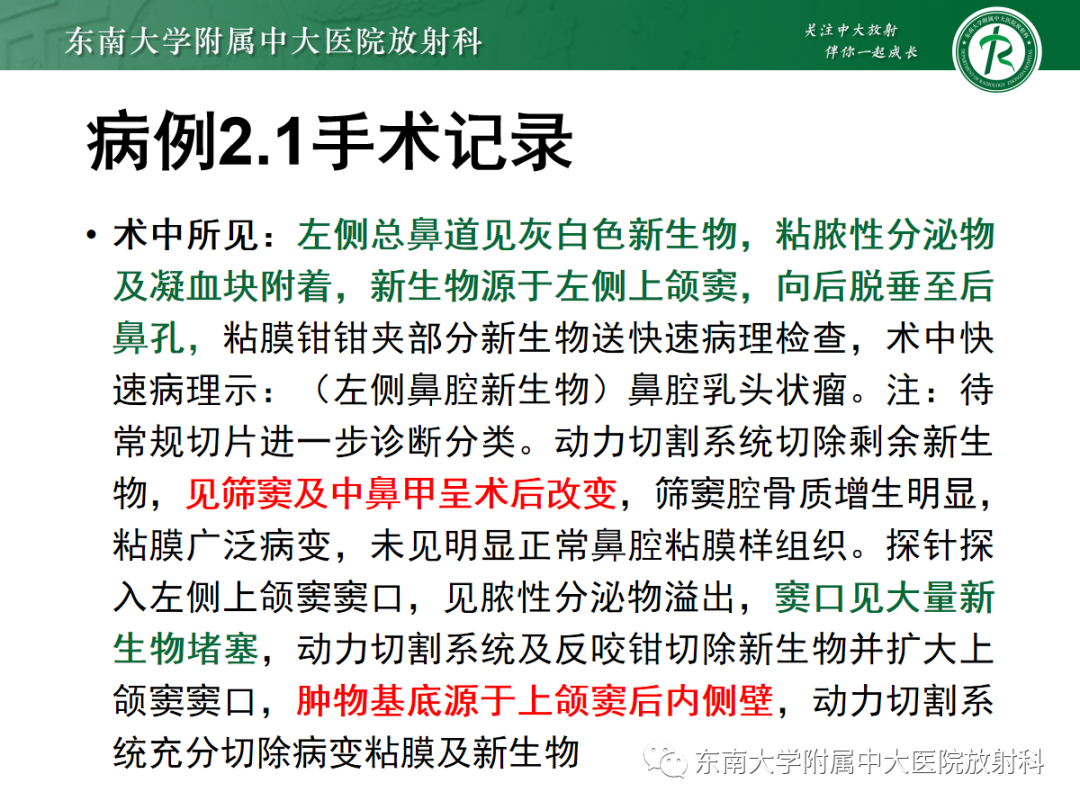 影像PPT - 【PPT】以上颌窦为中心的鼻腔鼻窦占位性病变随访-56